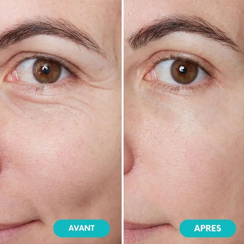 Masseur oculaire | EyeBeauty ™️